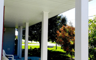 Fluted 6″x6″ White Post Wrap with Adjustable Collars